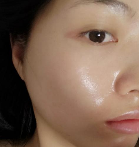 油性皮肤会一辈子油吗，油性皮肤不容易衰老为什么