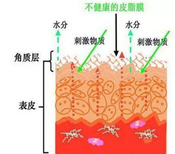 角质层薄怎么修复，角质层薄怎么修复小窍门